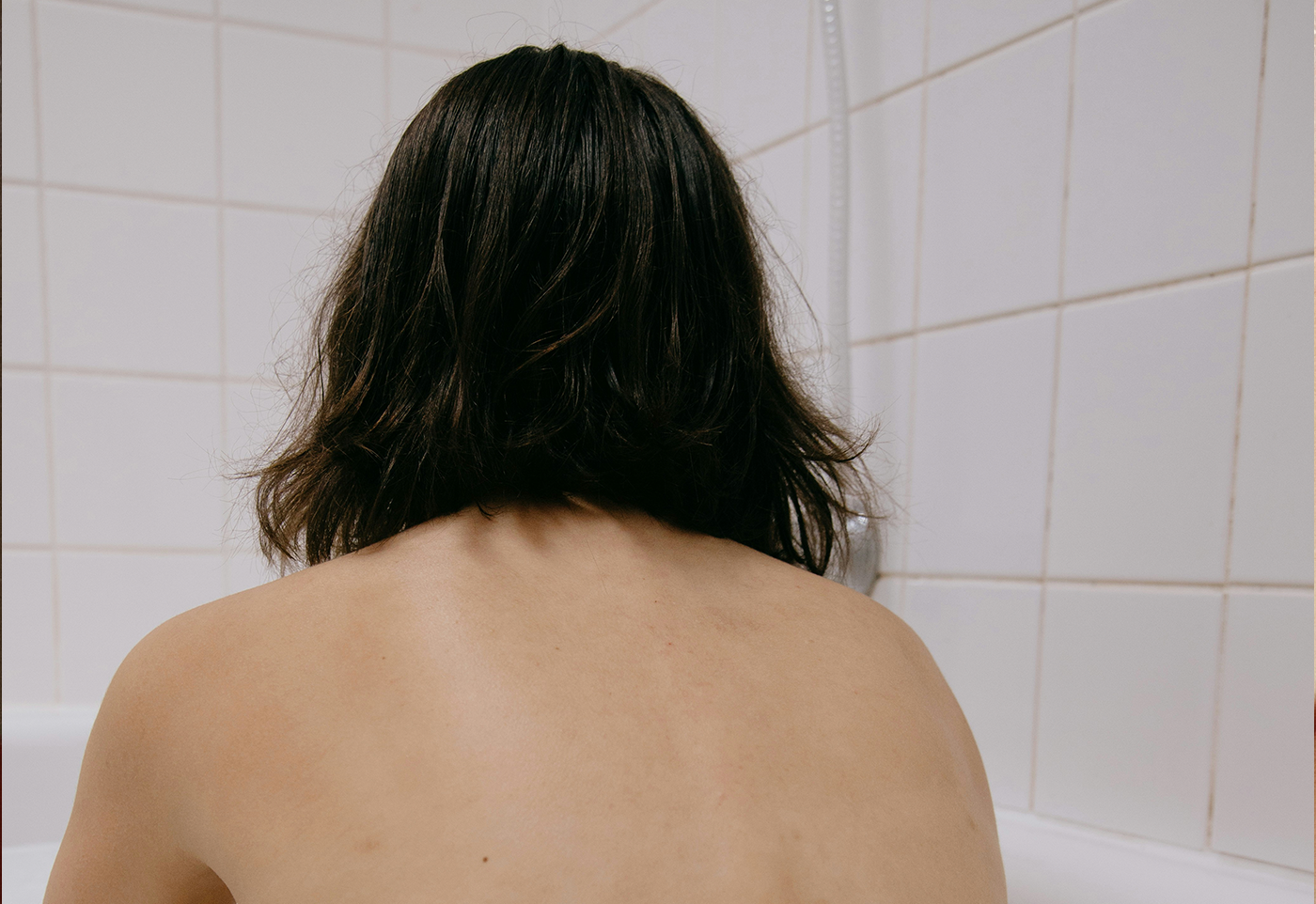 Don't Ignore Your Back: How to Get Rid of Back Acne